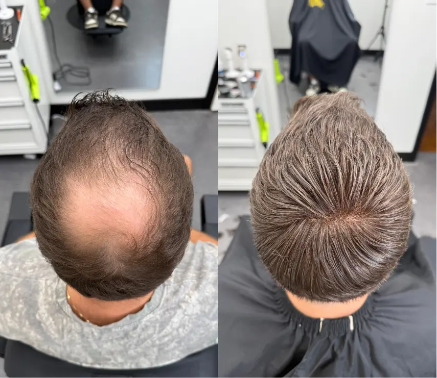 hairsystem macon -8